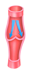 Superficial Veins One-way Valves 2